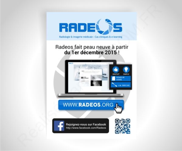 Radeos